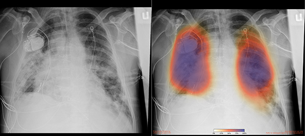 UC San Diego AI medical imaging
