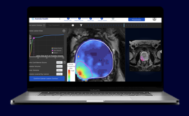 Avenda Health Unfold AI