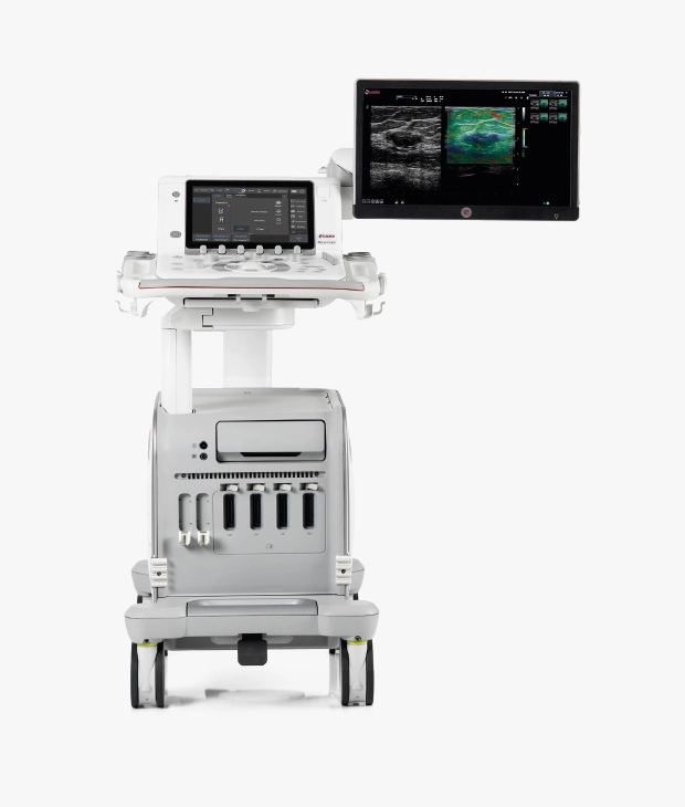 Esaote AI ultrasound