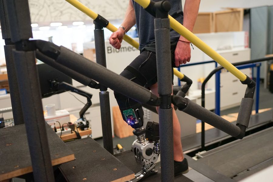 AI prosthetic arm natural movement control